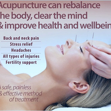 5 Benefits of Acupuncture: How It Can Improve Your Health and Well-Being